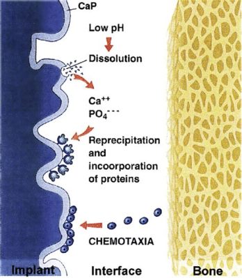  Dicalcium Phosphate: Révolutionnant la Biocompatibilité et l’Ostéoconduction !